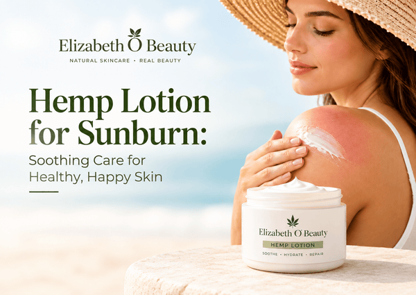Hemp Lotion for Sunburn: Understanding Its Benefits & Essential Nutrients! - EOB Website