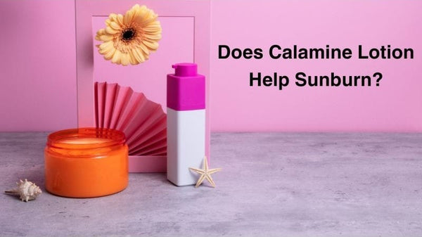 Calamine Lotion for Sunburn Relief: Uses, Application, and Safety Tips! - EOB Website