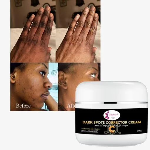 Knuckle Dark Spot Remover Cream