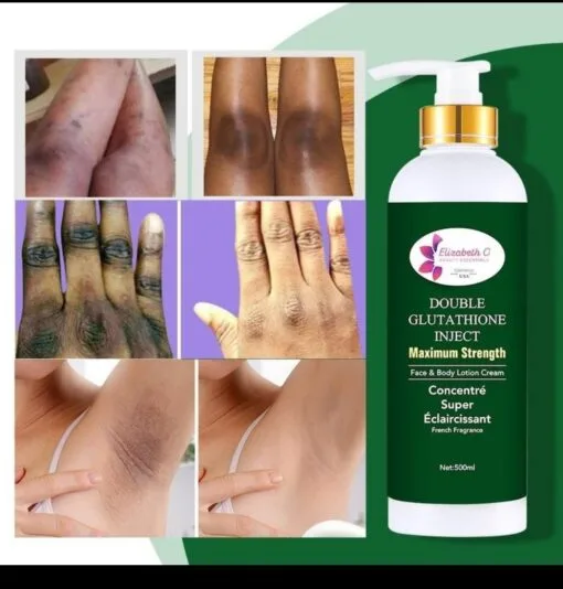 Double Inject Luxury Glutathione Whitening Lotion